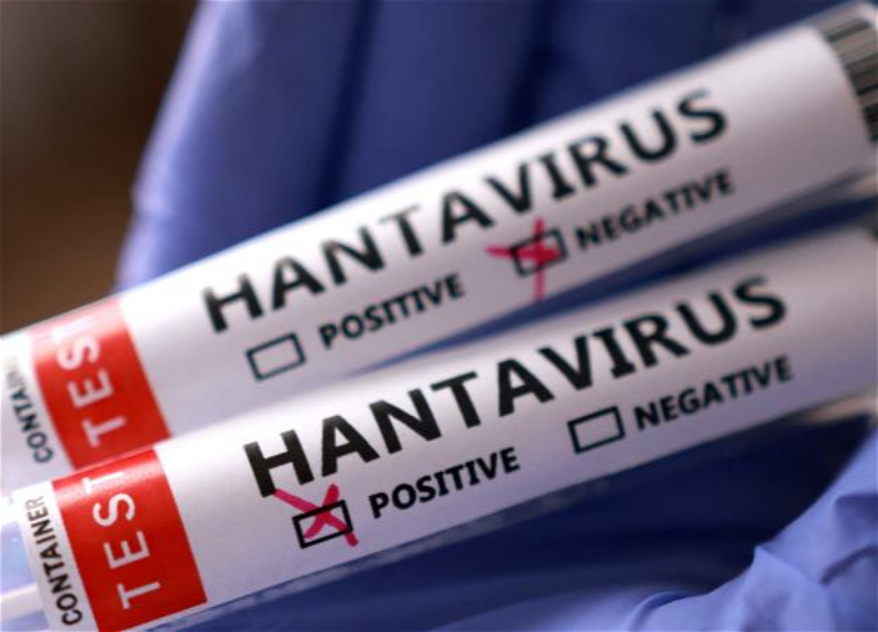 Hantavirus xəbərlərinə görə təşvişə düşməyin – Nazirlikdən çağırış