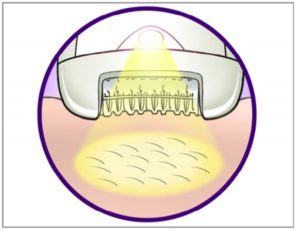 Opti-light